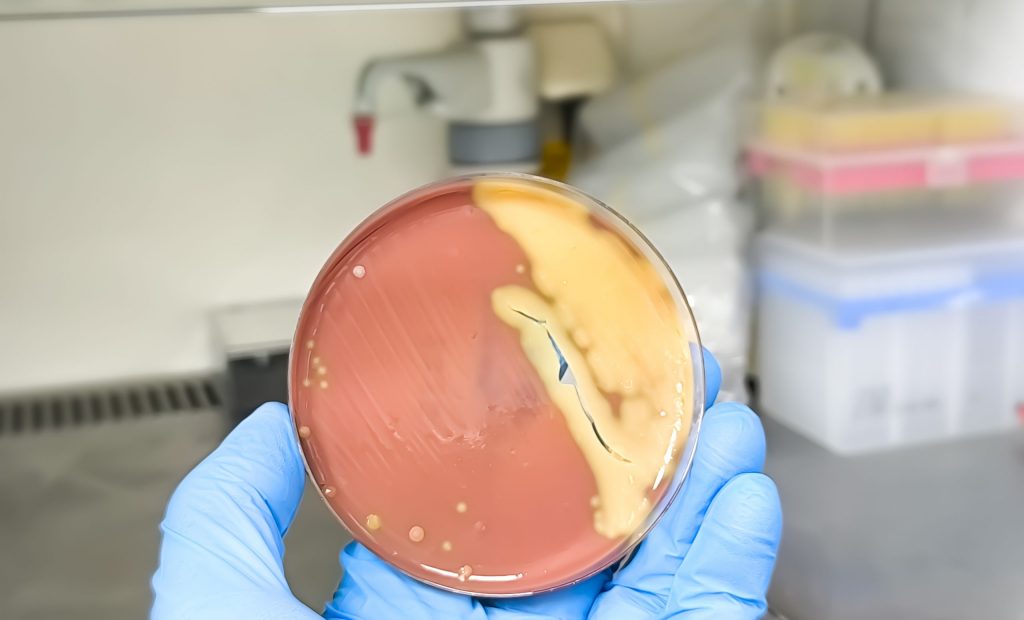 Streptococcus pneumoniae colony in blood agar media on petri dish in doctor hand.