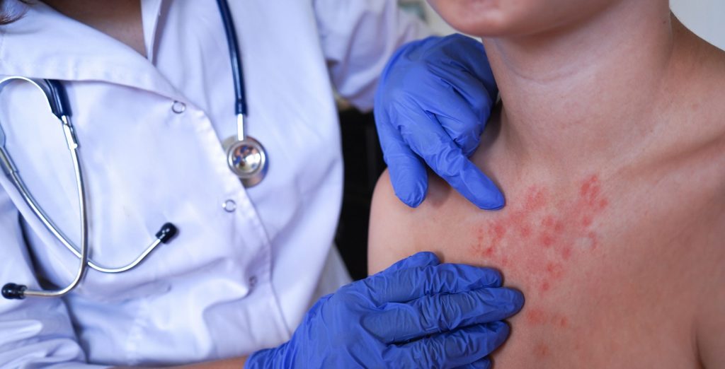 The doctor is examining the child’s skin for signs of illness. The doctor is examining the child's skin for signs of illness.