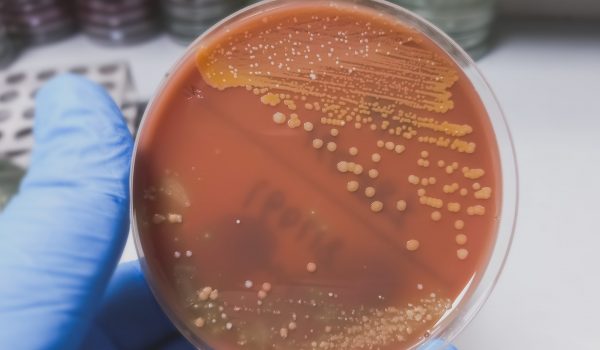 Golden color colonies on chocolate agar medium, growth of staphylococcus aureus, gram positive bacteria at medical microbiology laboratory. Golden staph.